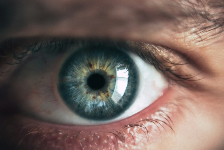 Glaucoma é a principal causa de cegueira irreversível no mundo; veja como se prevenir